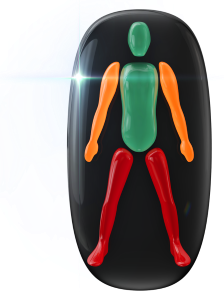 Movement moderately affected in the arms and highly affected in the legs.