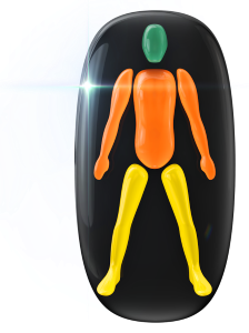 Movement and coordination moderately affected in the trunk and arms and mildly in the legs. 