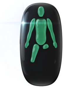 Absence of both legs; one from the knee and one just below the hip.
