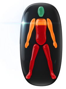 Moderately affected movement in the shoulders and arms and highly affected from the chest down in the trunk and in the legs.