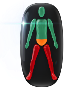 Movement moderately affected in the lower trunk and highly affected in the legs.