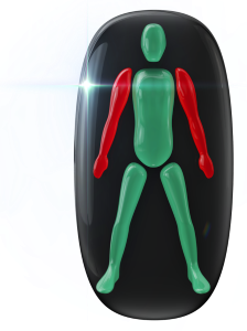 Movement affected to a high degree in the arms.