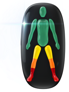 Movement affected in the legs; mildly at the top, moderately in the knees and to a high degree in the ankles and feet.