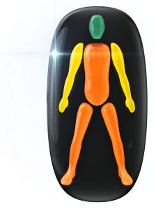 Movement of the trunk and legs moderately affected with the arms mildly affected.