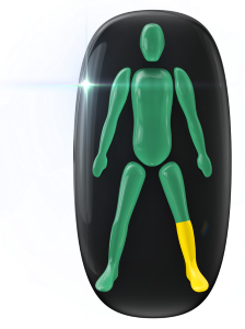 Movement and control mildly affected in on lower leg.