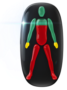 Movement and coordination affected to a high degree from the chest down and in the legs, with movement mildly affected in the hands.